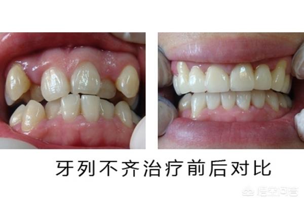 玉溪最新24小时牙医在线咨询方法分析(最方便真实的玉溪有没有24小时牙医方法)