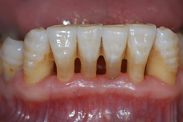 玉溪最新24小时牙医在线咨询方法分析(最方便真实的玉溪有没有24小时牙医方法)